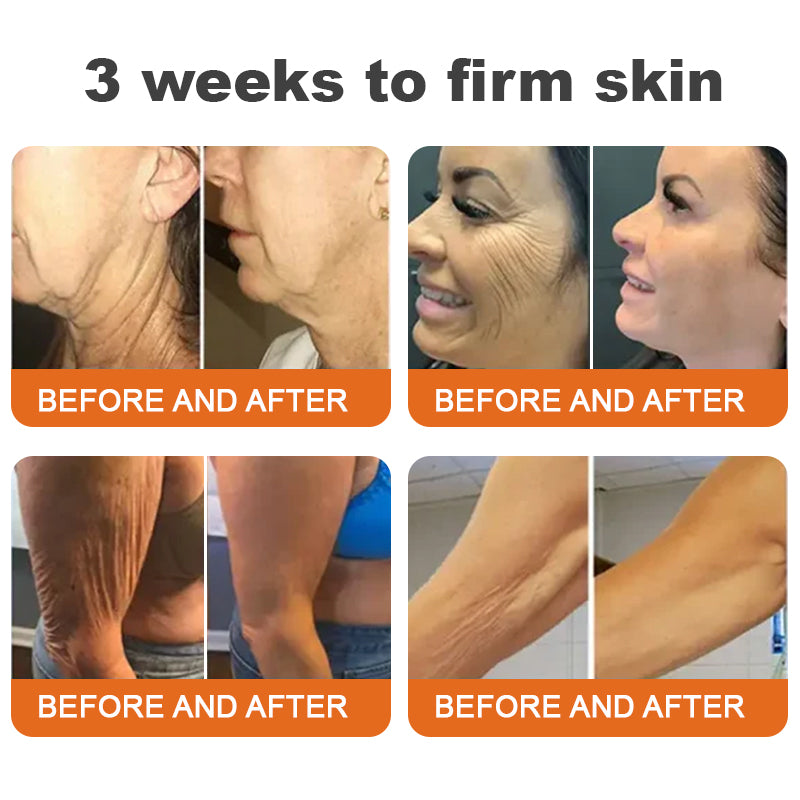🥰Made and Shipped from AU Rolimey® Botox Bee Venom Firming Serum Stick(⏳LAST DAY 70% OFF)✨